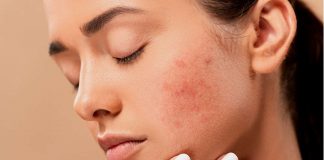 pelle grassa skincare