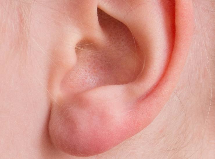 crosticine sotto orecchie