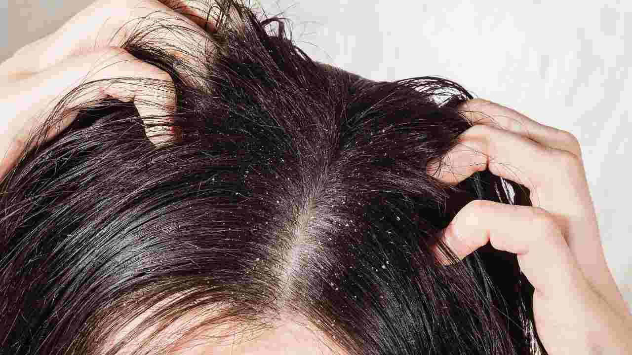 forfora capelli rimedio