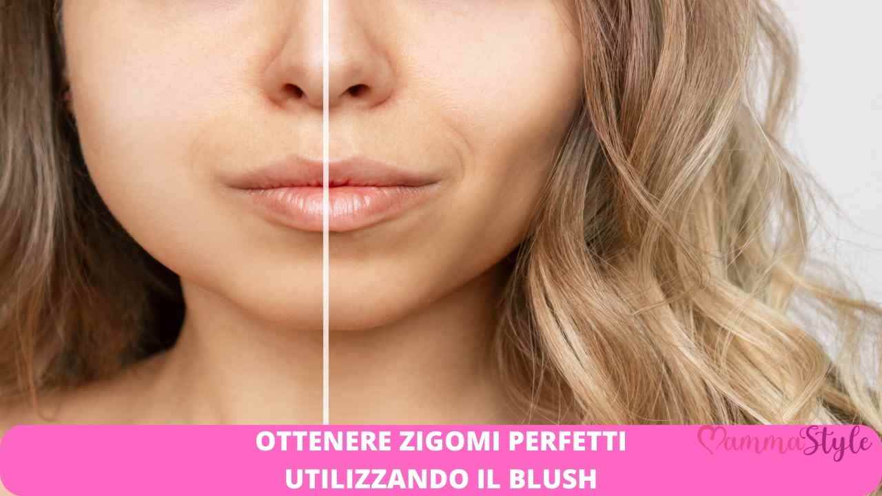 zigomi perfetti