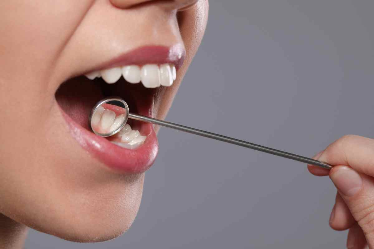 I cibi da preferire per prevenire le carie ai denti