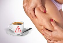 Come eliminare la cellulite
