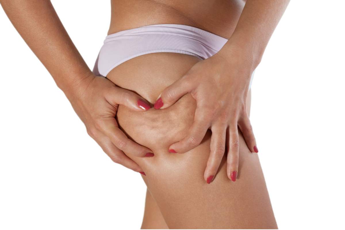 Un rimedio contro la cellulite