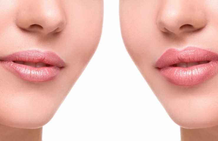 come correggere con il rossetto la forma di labbra sia sottili che carnose 