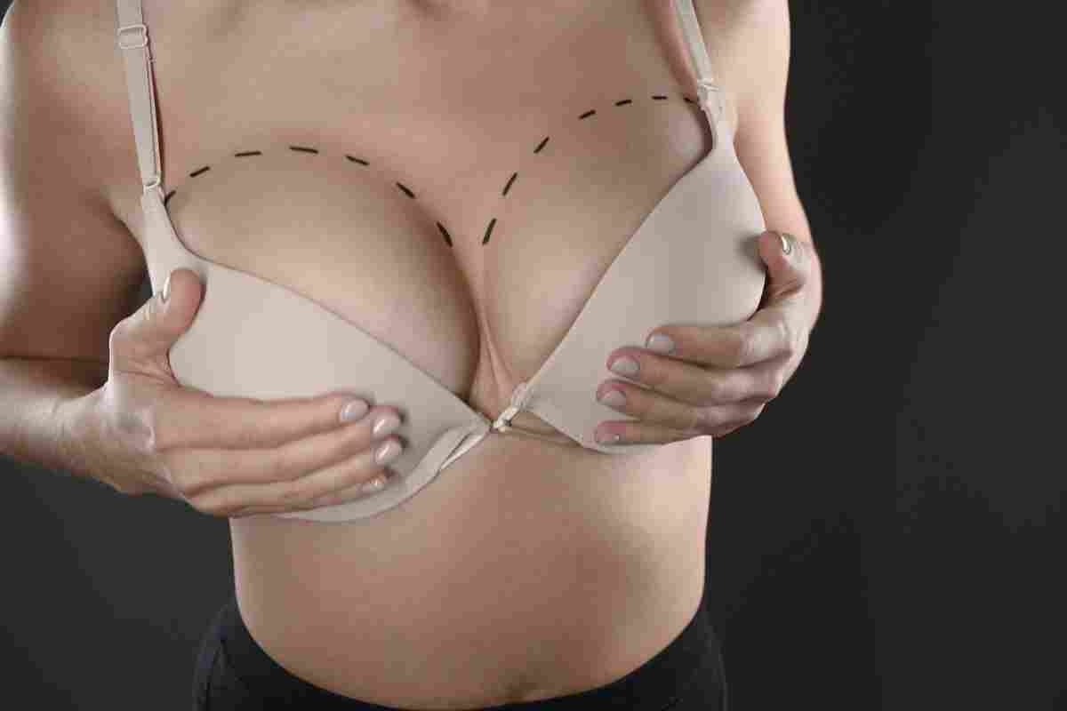 Dove costa di meno rifarsi il seno?
