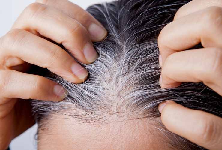 Cosa fare contro i capelli bianchi