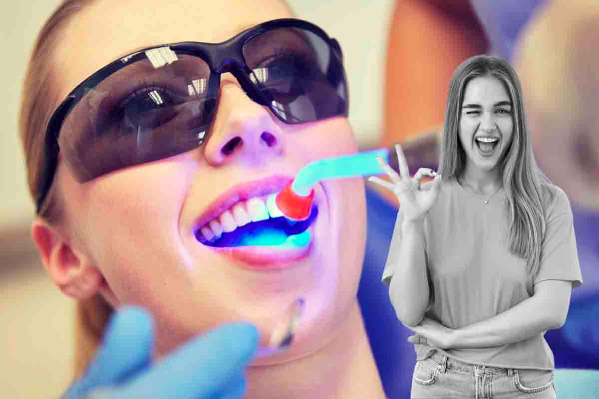 Sbiancamento dei denti a casa