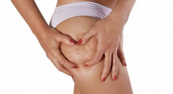 Cibi che dovresti consumare se soffri di ritenzione idrica: ti danno un grande aiuto